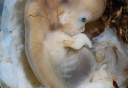 embryo-4